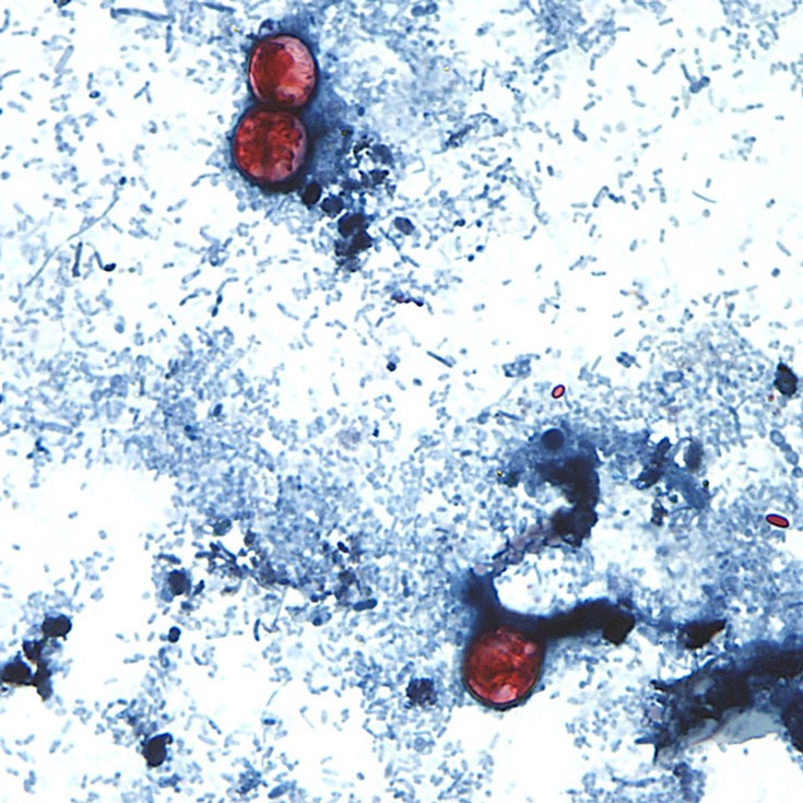 Michigan has reported more than 11,000 cases of cyclosporiasis, and two people have died. Melanie Moser/CDC/AP